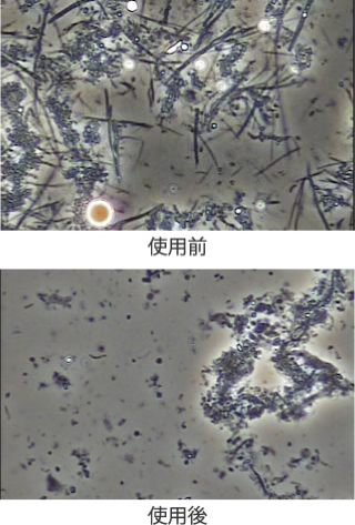 顕微鏡による症例のぺリオバスター効果例比較写真